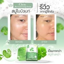 [สบู่ Cica ใบบัวบก] 🌿สบู่ใบบัวบก สำหรับคนแพ้ง่าย ปริมาณ 50กรัม ราคาสุดคุ้ม