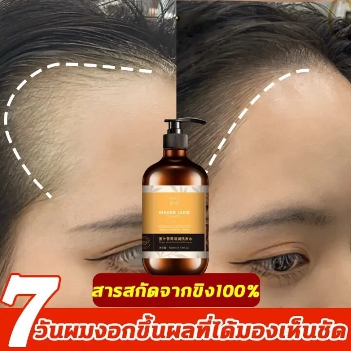 500MLแชมพูขิง แชมพูแก้ผมร่วง แชมพูปลูกผมดก แชมพูขิงเพียว แชมพูสมุนไพร สระผมแก้ผมร่วงสูตรแก้ปัญหาผมร่วง ผมบาง ปลูกผม เร่ง