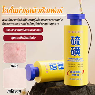 โลชั่นบํารุงผิว บรรเทาความแห้งกร้าน