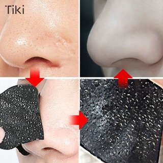 แผ่นแปะจมูก กําจัดสิวเสี้ยน สิวหัวดํา ลอกออกได้ แผ่นแปะจมูก …