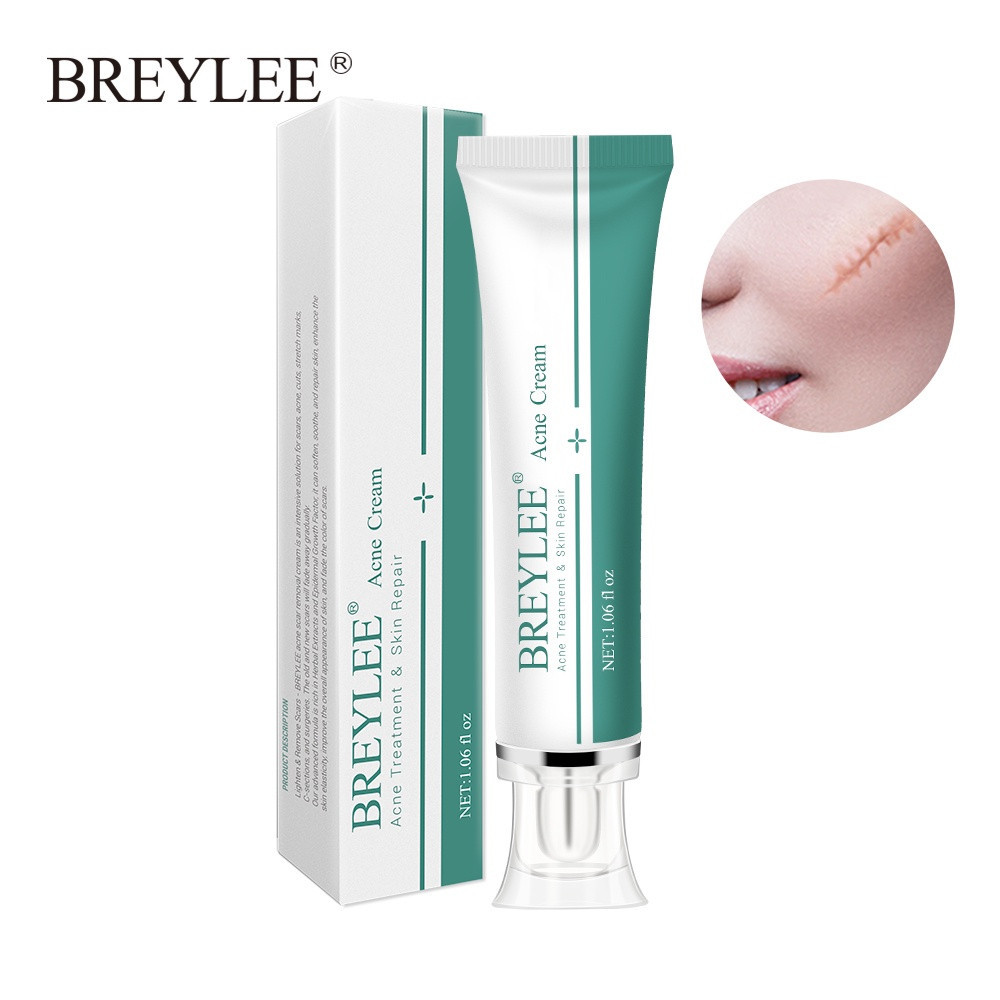 【 BREYLEE 】 Acne Scar Removal Cream Acne Scar Removal Cream Acne Scar Size Acne Scar Treatment Cream