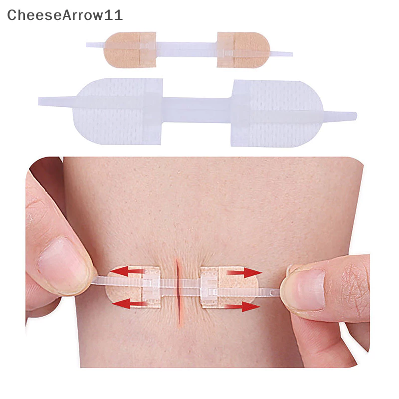 Che Zipper Tie Wound Closure Patch Hemostatic Patch Wound Fast Suture Zipper Band TH