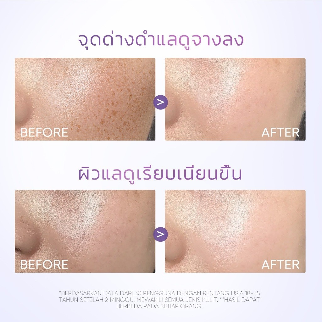 [Ready] SKINTIFIC Symwhite 377 เซรั่ม เซรั่มลดเลือนจุดด่างดำ（เซรั่มลดฝ้าแดด ฝ้าสะสม กระ จุดด่างดำ เพื่อผิวหน้ากระจ่างใส）