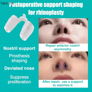 Two-th หลังผ ่ าตัดจมูกสนับสนุนซิลิโคน Shaping Crooked Nose Correction Fixator ซิลิกาเจลคลิปจมูกใหม ่