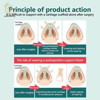 [goushbshiy ] หลังผ ่ าตัดศัลยกรรมจมูกสนับสนุนซิลิโคน Shaping Crooked Nose Correction Fixator ซิลิกาเจลคลิปจมูก TH