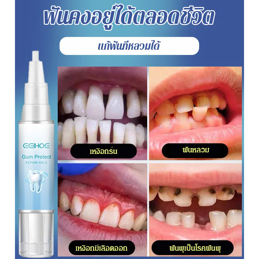 🌴【คุณภาพสูง】เจลซ่อมแซมฟัน ฟันขาวขึ้น ขจัดคราบหินปูน ลมหายใจหอมสดชื่น บรรเทาอาการเหงือกบวมและปวด เจลซ่อมแซมฟันที่สะอาดล้ำลึก - รูปที่ 3