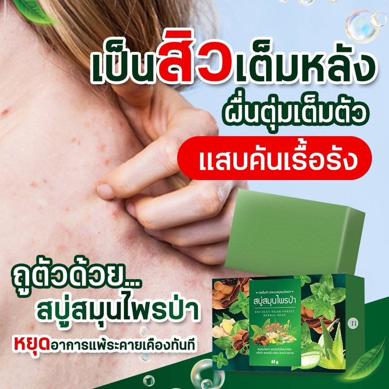 สบู่แก้คัน สบู่สมุนไพร สบู่สมุนไพรป่า สวยงาม สบู่สมุนไพรป่า ผิวหนังแพ้เหงื่อ ผื่นคัน สูตรยับยั้งแบคทีเรีย ขนาด 65 กรัม