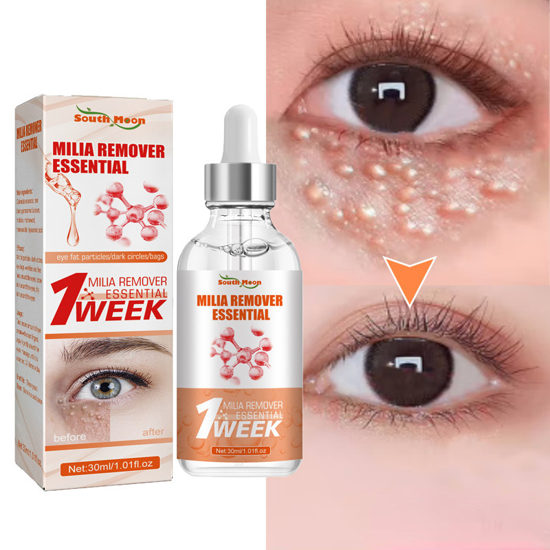 เม ็ ดไขมัน Removal Eye Serum Eye Milia Repair Treatment ผลิตภัณฑ ์ ริ ้ วรอย Lifting Moisturizing Anti-Puffiness Skin Care