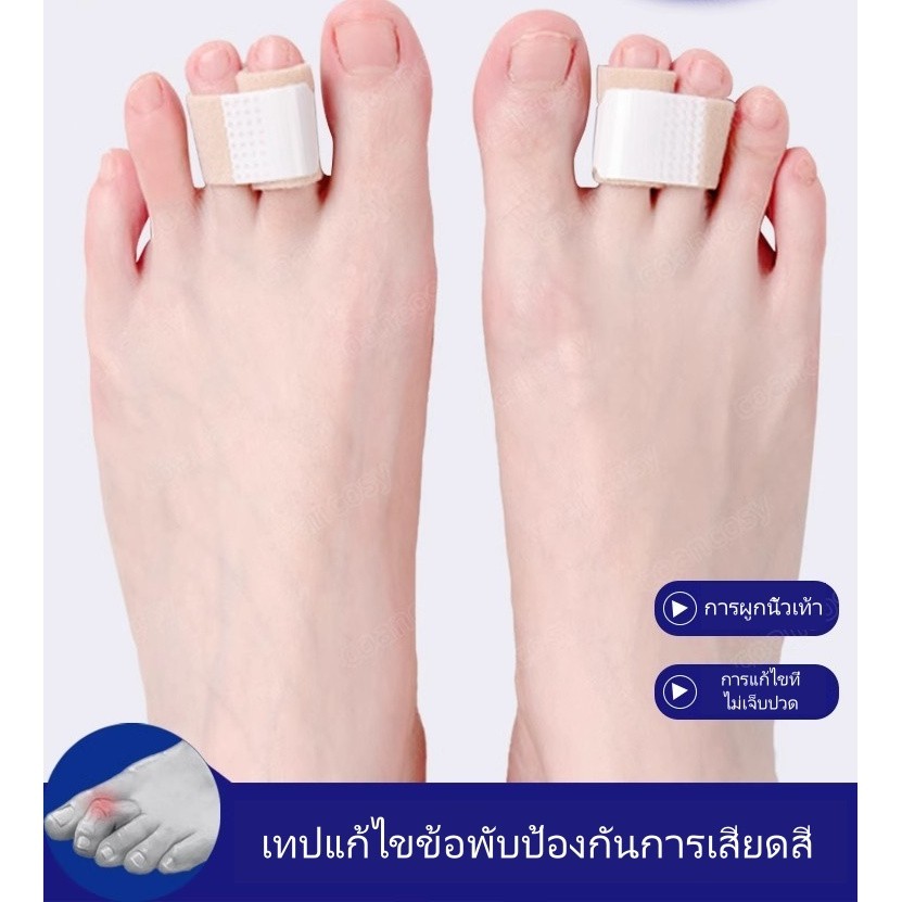 Sanli อุปกรณ์แก้ไขนิ้วเท้าเอียง/ผ้าพันนิ้วขนาดเล็ก/อุปกรณ์แยกนิ้วเท้าทับซ้อนกันสำหรับใช้ในเวลากลางวันและกลางคืน - รูปที่ 3