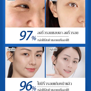 💕ของแท้อย่างเป็นทางการ💕【COD】เซรั่มลดเลือนเข้มข้นให้ความชุ่มชื้น/สารสกัดจากธรรมชาติ/เซรั่มลดเลือนริ้วรอยออร์แกนิก/ไม่มีสารเคมีอันตราย/ลดรอยตีนกา/ริ้วรอยแก้ม/ริ้วรอยหน้าผาก/เหมาะสำหรับทุกสภาพผิว/保湿浓缩抗皱精华液