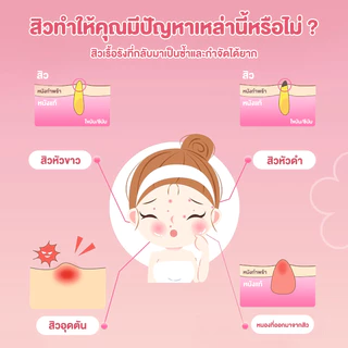 แผ่นซับสิว แผ่นสิว สําหรับติดตกแต่งสิว ดูดสิว สำหรับปกปิดจุดด่างใบหน้า การยึดเกาะที่แข็งแรง ไม่หลุดง่าย ลายการ์ตูน