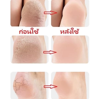 Novvia ซิลิโคนรองส้นเท้า ใส่ได้ทั้งชายหญิง ถนอมส้นเท้า แก้ปวดส้นเท้า รองช้ำ ส้นเท้าแตกของแ Silicone Heels Cover