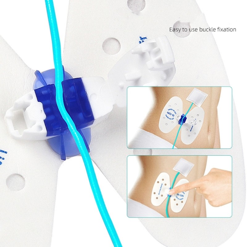 Top Butterfly Closed Catheter กาวสําหรับโรงพยาบาล Home Nursing Scenarios