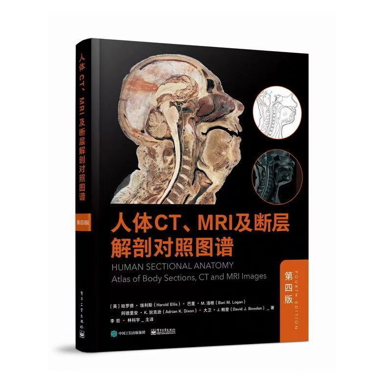 ฟูลฟูลคัลเลอร์CT MRI สําหรับการเดินทางที่เหมาะกับการหมุนเวียนของห้องออกกําลังกาย 4 สีเต็มรูปแบบ CT M