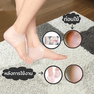 ซิลิโคนรองส้นเท้า ใส่ได้ทั้งชายหญิง ถนอมส้นเท้า แก้ปวดส้นเท้…