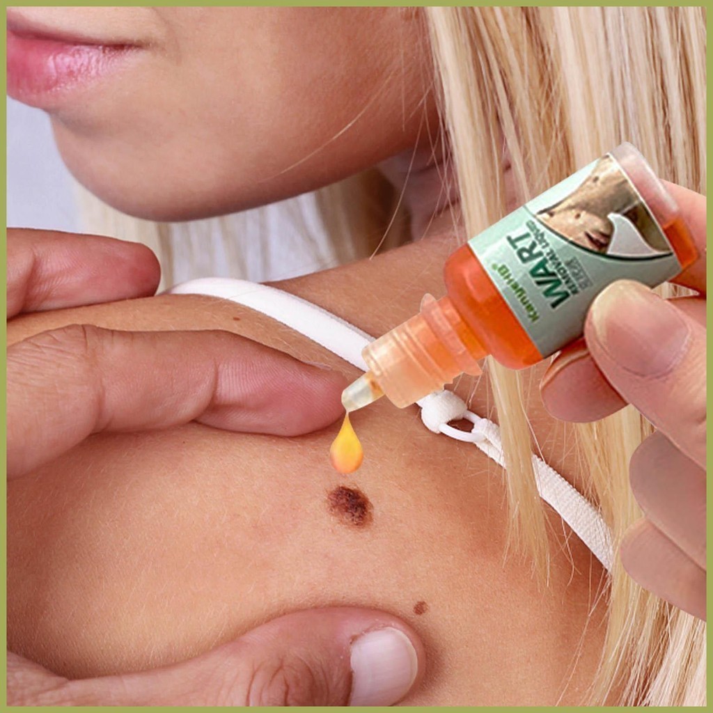 Wart Removal Liquid Common Genital Wart Remover Skin Tags Remover Flat Warts Removal Fluid ลบข้าวโพด