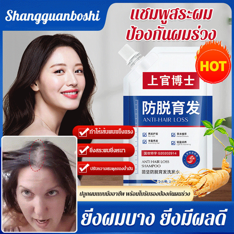 แชมพูป้องกันอาการคันและป้องกันการรั่วซึม แชมพูป้องกันการรั่วซึม