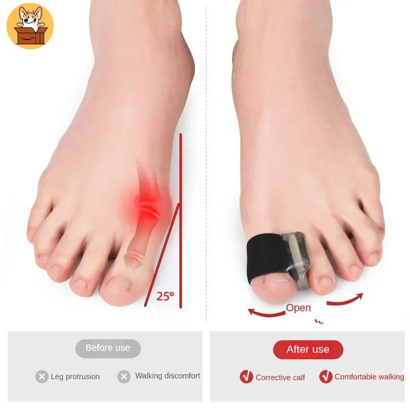 Am-az2ชิ้นเจลนิ้วเท้าแยกตาปลา Corrector สําหรับ Bunion Overlopping และค้อนบรรเทานิ้วเท้าพร้อมตัวเว้นวรรคนิ้วเท้าซิลิโคนเครื่องมือดูแลเท้า