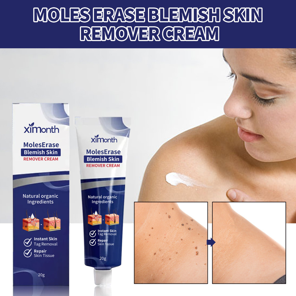 XIMONTH Kyu ครีมทําความสะอาดผิว Fade Skin เนื้อหมองคล้ําเม็ด Kyu Care ครีม tzp0714