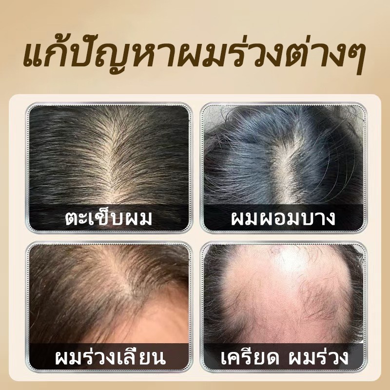 ซื้อ 1 แถม 1สินค้านำเข้าPEIMEI แชมพูแก้ผมร่วง แชมพูสมุนไพรขิงบำรุงผม 250ml แชมพูปลูกผม ยาสระผมแก้ร่วง แชมพูขิงเพียว - รูปที่ 2