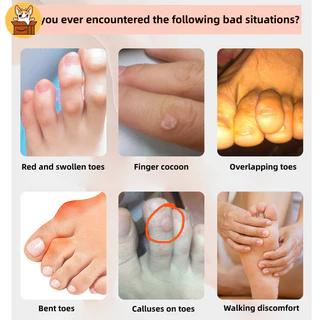 Am-az2pcs ซิลิโคนเจล Toe Protection Sleeve Pedicure Little Finger Tube Corns Blisters Bunion Corrector Pinkie Protector