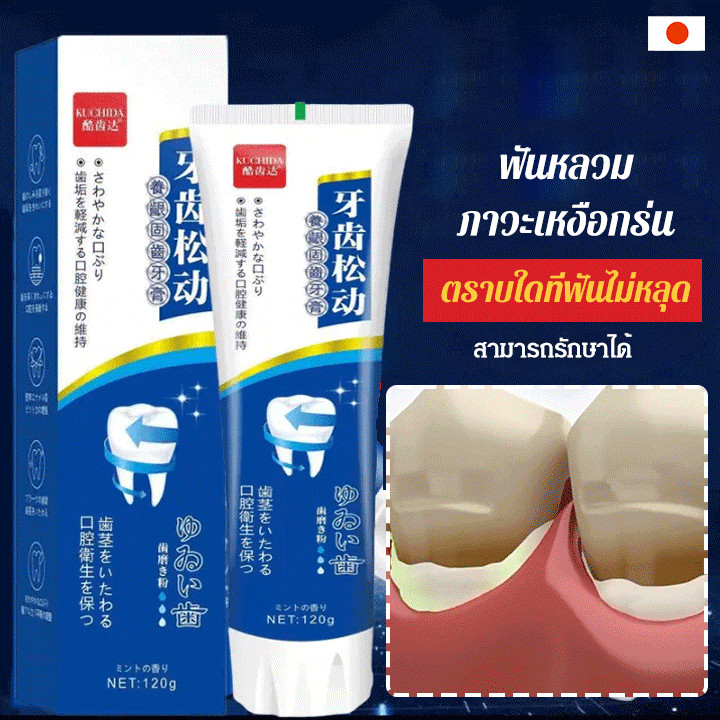 ยาสีฟันไวท์เทนนิ่ง ป้องกันฟันผุ สําหรับฟันหลวม