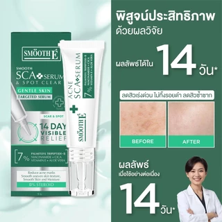 Smooth E เซรั่มลดรอยแผลเป็นจากสิว Smooth E Acne Scar Serum 7g. ลดจุดด่างดำ ลดรอยดำ หลุมสิว แผลคีลอยด์ เห็นผลใน 2 สัปดาห์