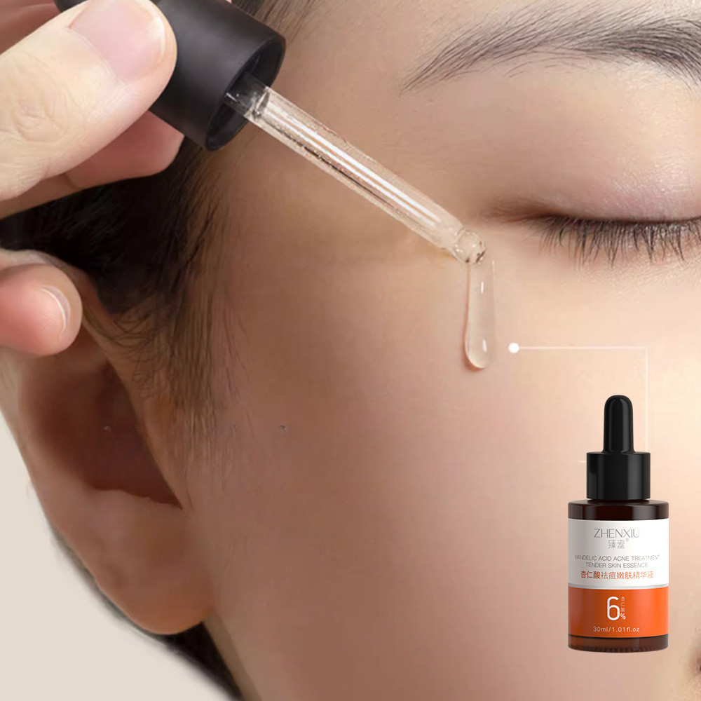 ZHENXIU 6% เซรั่มกรดอัลมอนด์ สกินแคร์ Mandelic acid สิว สิวหัวดํา Essence Pore Shrink