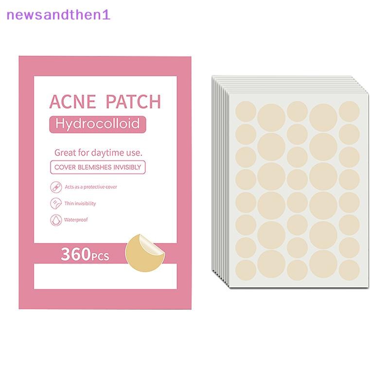 Newsandthen1 360pcs Pimple Patch สิวที่มองไม่เห็นกําจัดสิว Skin Care สติกเกอร์คอนซีลเลอร์ Face Spot 