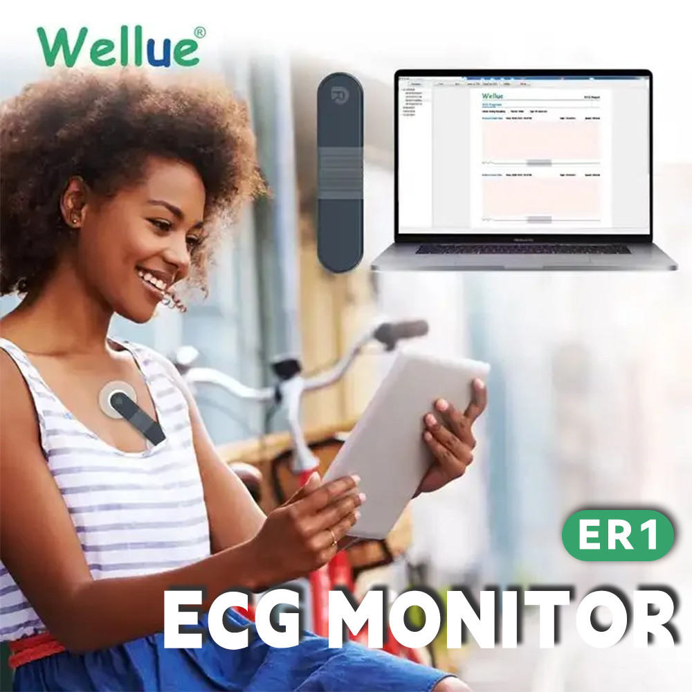 Wellue Holter Ecg 24 ชั่วโมงเครื่องบันทึก Holter Ai-Ecg การวิเคราะห์ Heart Monitor Ekg เครื่องสวมใส่