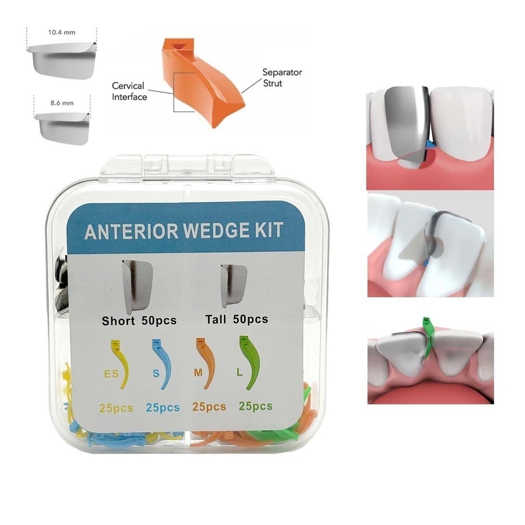 200 ชิ้น/เซ็ตทันตกรรม Anterior Matrix System Wedge Matrix Bands Interdental Wedges ทันตกรรมวัสดุสิ้นเปลืองเครื่องมือมืออาชีพ