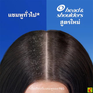 เฮดแอนด์โชว์เดอร์ แชมพูขจัดรังแค สูตรสมูธแอนด์ซิลกี้ 370 มล. แพ็ค 1+1
