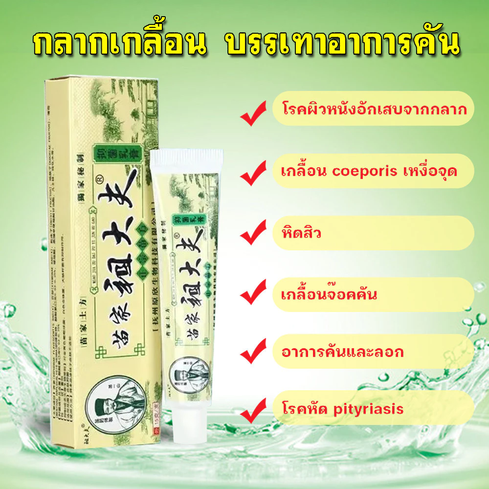 ZDF ครีมดูแลสะเก็ดเงิน บรรเทาอาการคันและแดง