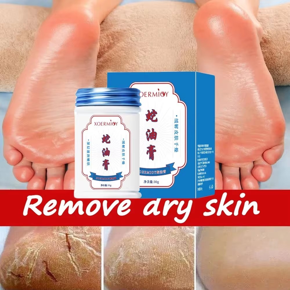 30g ผลิตภัณฑ์ความงามสมุนไพร Anti Crack Foot Cream Heel Cracking ผลิตภัณฑ์ซ่อมแซม Exfoliaation Dead Skin Removal Softening Moisturize เครื่องมือ