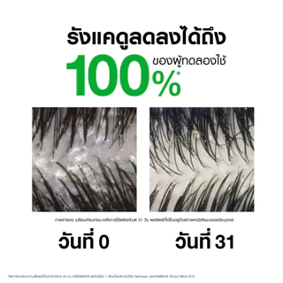 [เซตขจัดรังแค ผมลีบแบน] วิชี่ VICHY DERCOS ANTI-DANDRUFF SHAMPOO และ DENSI-SOLUTIONS SHAMPOO