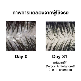 วิชี่ VICHY DERCOS ANTI DANDRUFF DS 2 IN 1 CONDITIONING SHAMPOO แชมพูผสมครีมนวด ขจัดปัญหารังแคและลดความคันบนหนังศีรษะ