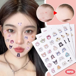 สติกเกอร์สิว วิชาพลศึกษา สีการ์ตูนหลายสีกระดาษไฮโดรเจลถุงอลูมิเนียมฟอยล์พลาสติก