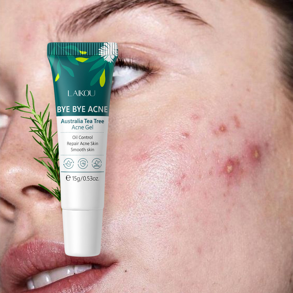 Bye BYE Acne - LAIKOU Australia Tea Tree Acne Gel 15g เจลแต้มสิว ลดรูขุมขน ลดสิวบนใบหน้า และลดการสะสมของเคราติน ปลอบประโลม ซ่อมแซม และผิวที่เป็นสิวเรียบเนียน