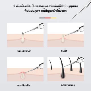 คีมหนีบสิว ที่กดสิว ที่ดึงสิวเสี้ยน กำจัดสิวเสี้ยน คีมดึงหัวสิว อุปกรณ์คีบสิวกดสิว ที่หนีบสิว แหนบดึงสิวเสี้ยน