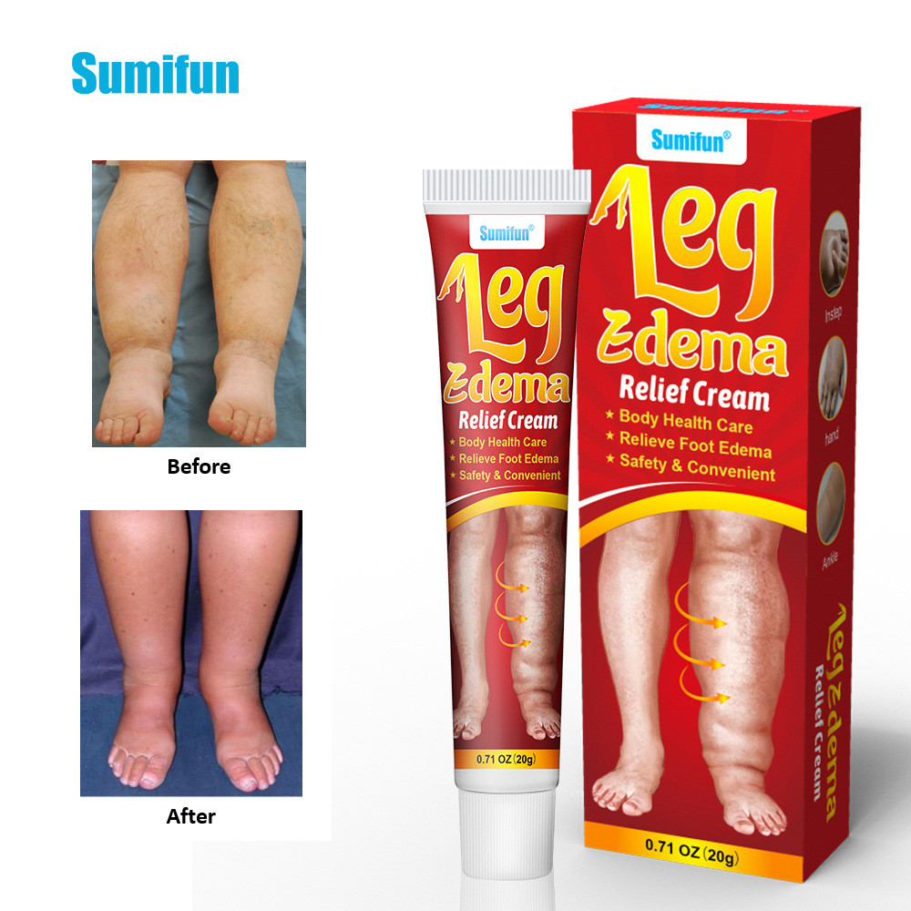 Anti-Edema ครีมขาลอย Edema กล้ามเนื้อ Enema Care ครีมนวด