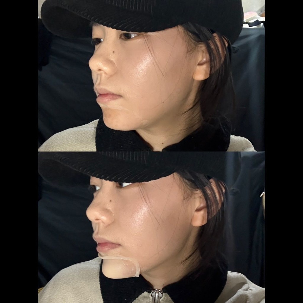 คอสเพลย์คางปลอมซิลิโคน// wtt2025.7.3