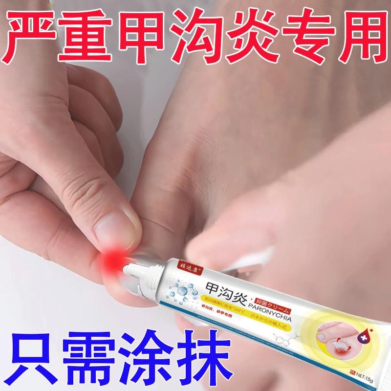 Red Paronychia ครีมพิเศษสําหรับ Paronychia เล็บบวมสีแดง Pseudo-Reduction Pseudo-Reduction Pse