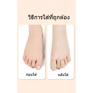 ปลอกนิ้ว ไนลอน สำหรับนิ้วเท้า คุณภาพดี ช่วยกันนิ้วเสียดสี ป้องกันตาปลา พร้อมส่งจากไทย