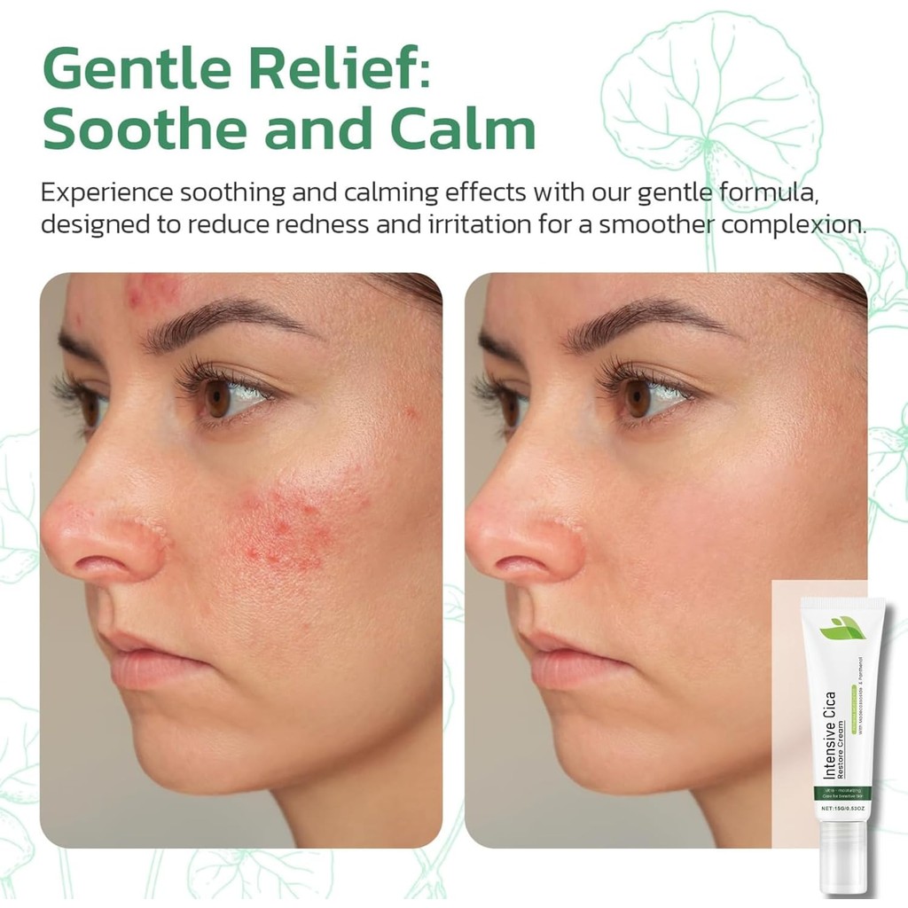 15g Intensive Cica Repair Cream, Centella Moisturizer Phytocin Cream Soothing Centella Asiatica Mois