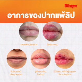 Blistex Lip Infusions Restore ลิปบาล์ม ลดการอักเสบ ปากแห้งแตกลอก ริมฝีปากชุ่มชื้น เรียบเนียน รับรองจากแพทย์ผิวหนัง USA