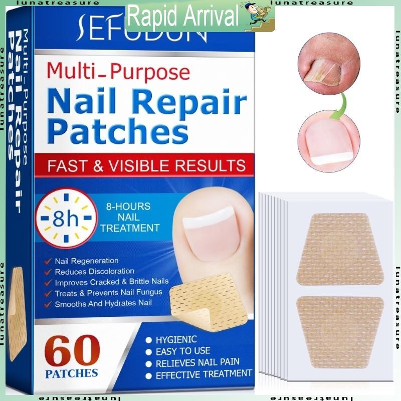 Lun แพทช์แก้ไขเล็บเท้าคุด พลาสเตอร์สติ๊กเกอร์ดูแลแก้ไขเล็บ Paronychia Treatment Recover Corrector Pedi