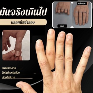 ฝาครอบนิ้วเทียม ชุดนิ้วเท้า เพิ่มความมั่นใจ ตกแต่งรูปลักษณ์ข…