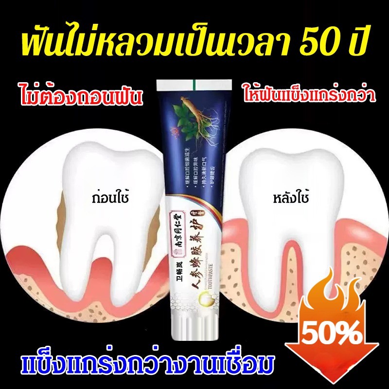 [ฟันหลวมหายได้101%]ยาสีฟันรักษาอาการฟันหลวมนำเข้าจากญี่ปุ่น/ยาสีฟันโปรไบโอติก/ยาสีฟันโสมโพลิสไวท์เทนนิ่ง/ยาสีฟันกัมแคร์ไ