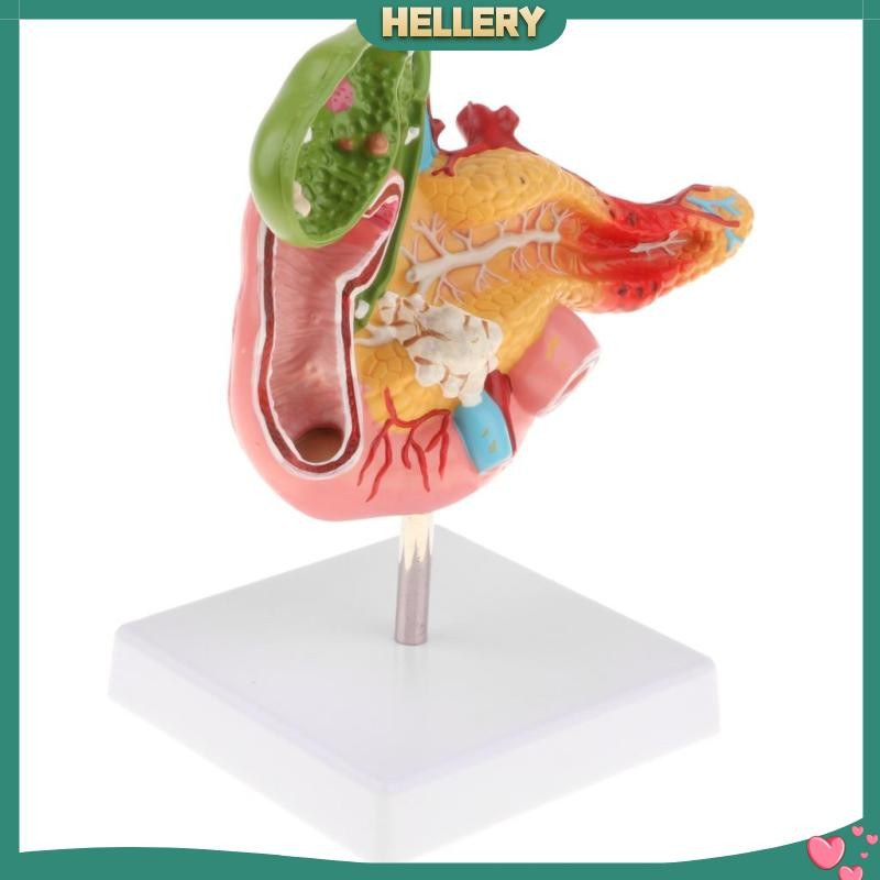 [HelleryTH] Lifesize Human Pancreas Duodenum Gallblader Model with Vessel & Nerves, School Teaching Aid