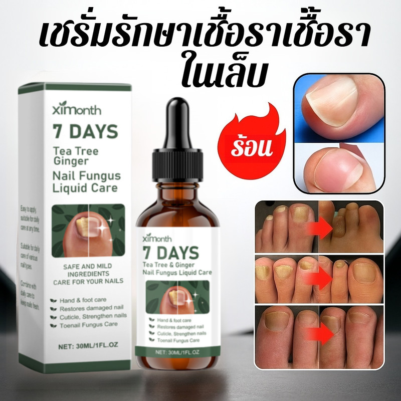 1/2/3/4/5 bottles ✨รักษาโรคเชื้อราที่เล็บใน 7 วัน✨[ซื้อ 2 แถม 3 ฟรี]น้ำยาบำรุงดูแลเชื้อราที่เล็บ โซลูชั่นดูแลเล็บ เพิ่มความหนา เงางาม บํารุงเข้มข้นใน 7 วัน ใช้ได้ทุกที่ทุกเวลา ปริมาณ 30มล